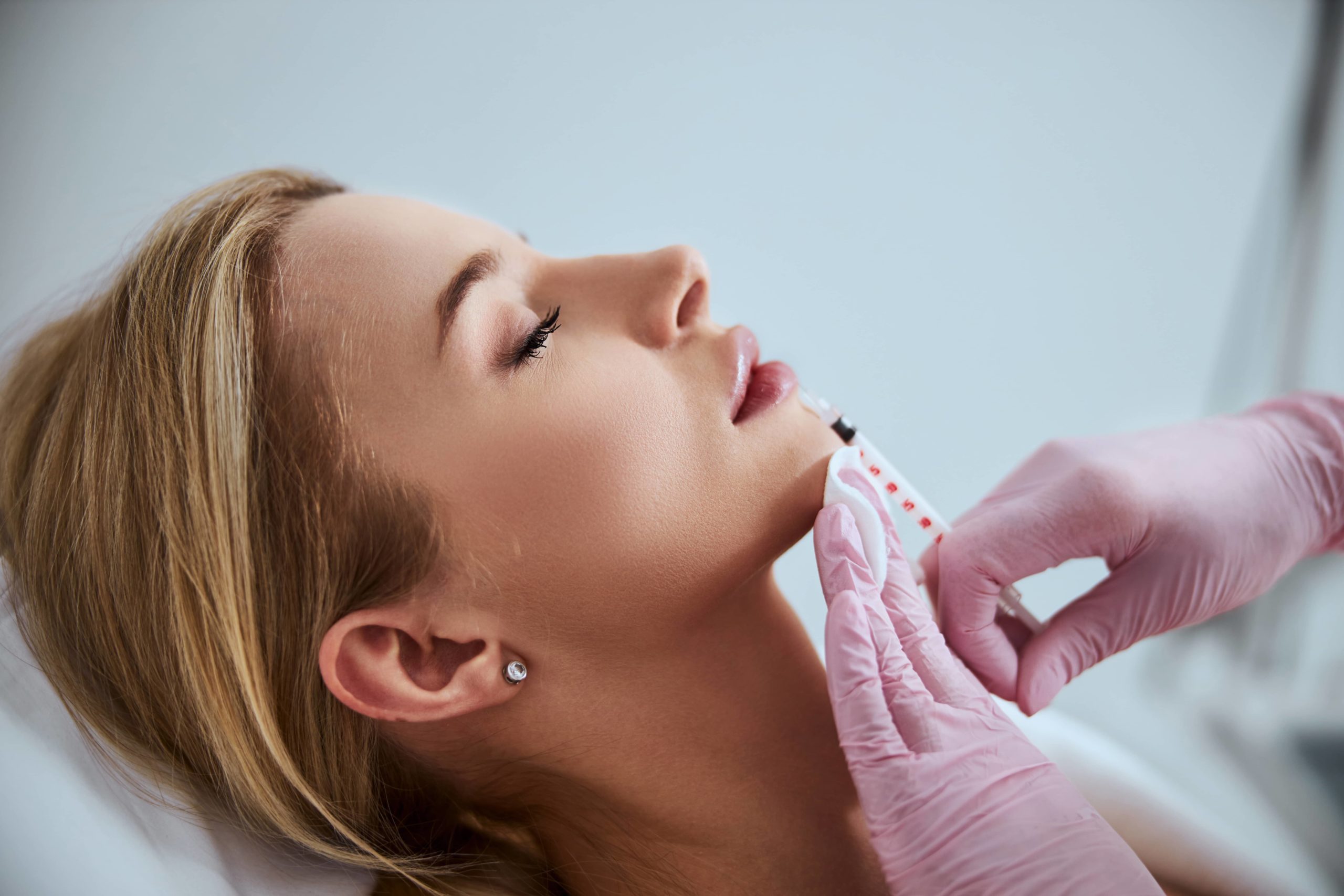 How are Dermal Fillers Beneficial