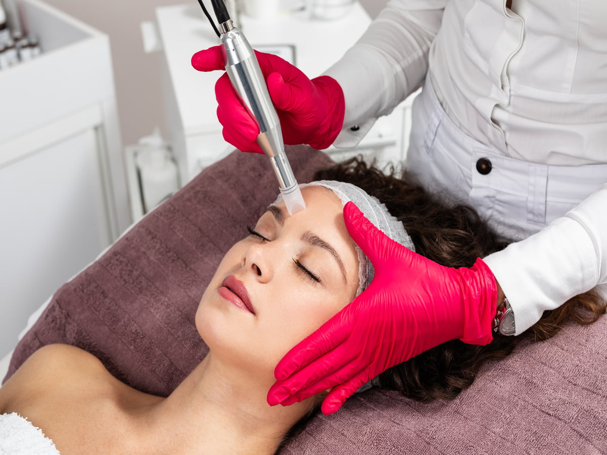 Microneedling Treatment by Beauty Boss Co. Aesthetics & Wellness in Cabot AR