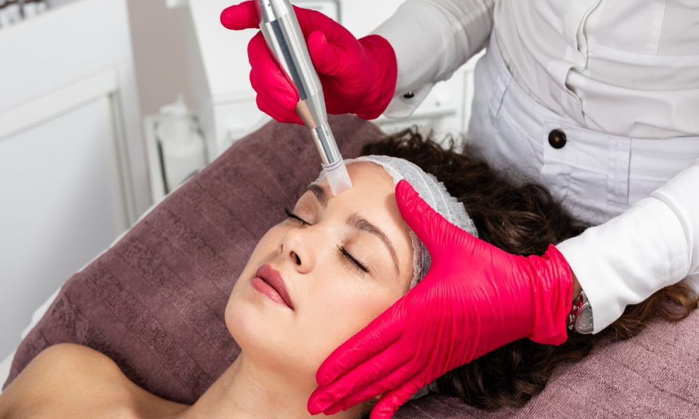 Microneedling Treatment by Beauty Boss Co. Aesthetics & Wellness in Cabot AR