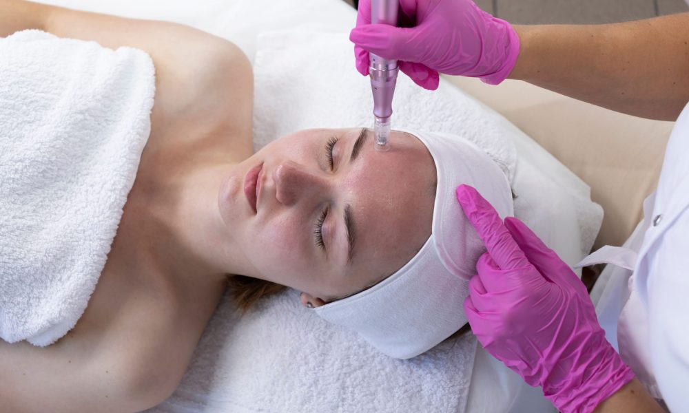 Microneedling Treatment by Beauty Boss Co. Aesthetics & Wellness in Cabot AR